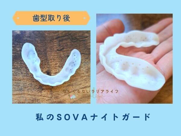 SOVAナイトガードの歯型の取り方②